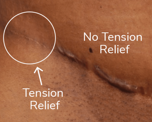 Tension relief image-min